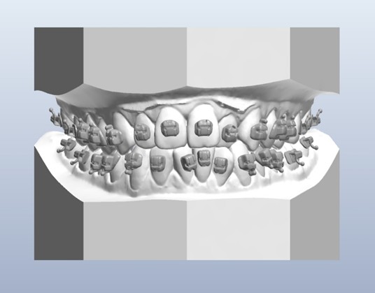 Cross-positioning 3D